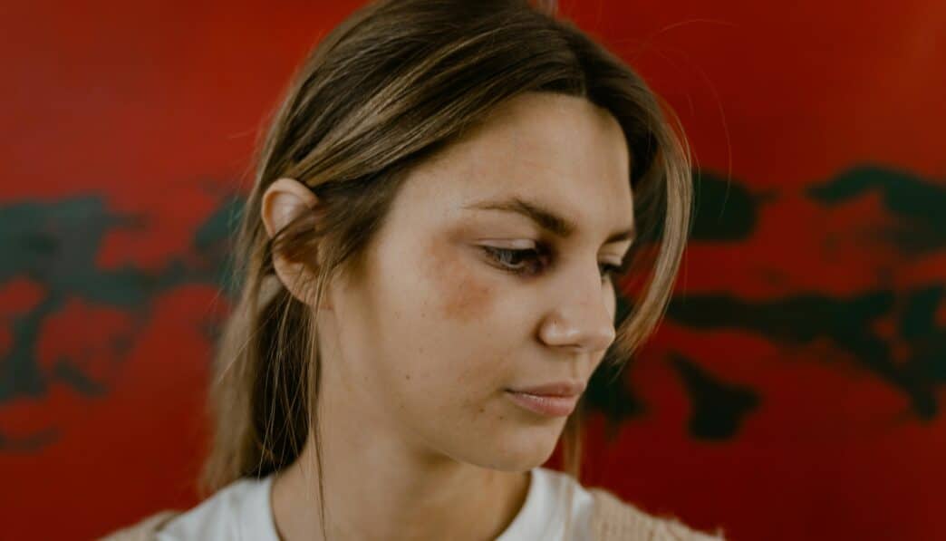 Close-up portrait of a woman with a bruised eye looking down, conveying emotion against a red backdrop.