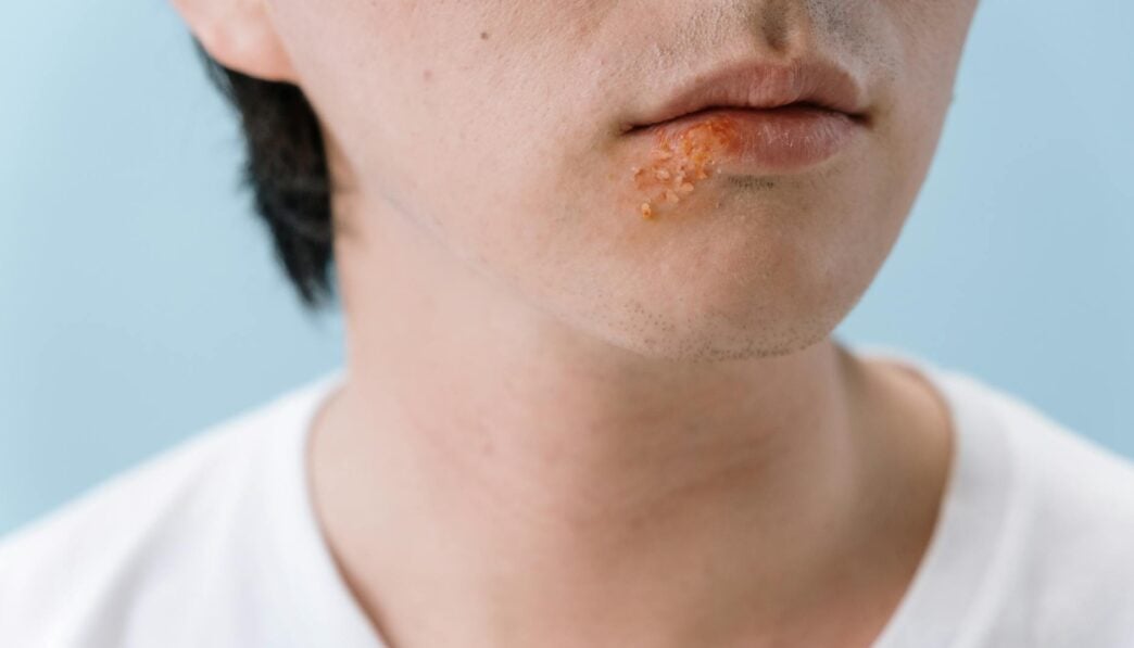 PTSD and Psychosis: Understanding Symptoms and Treatment Options